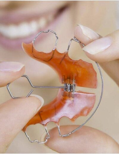 Ayelen : Clínica Dental en Chillán especializada en ortodoncia e implantes