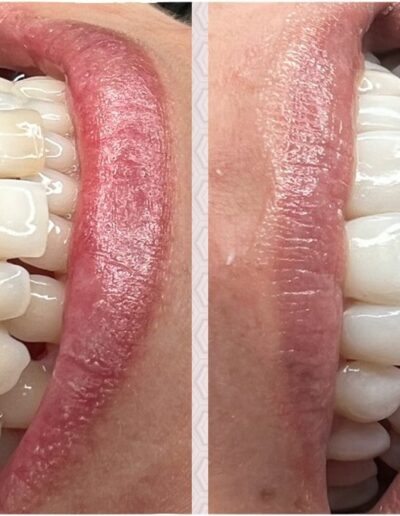 Ayelen : Clínica Dental en Chillán especializada en ortodoncia e implantes